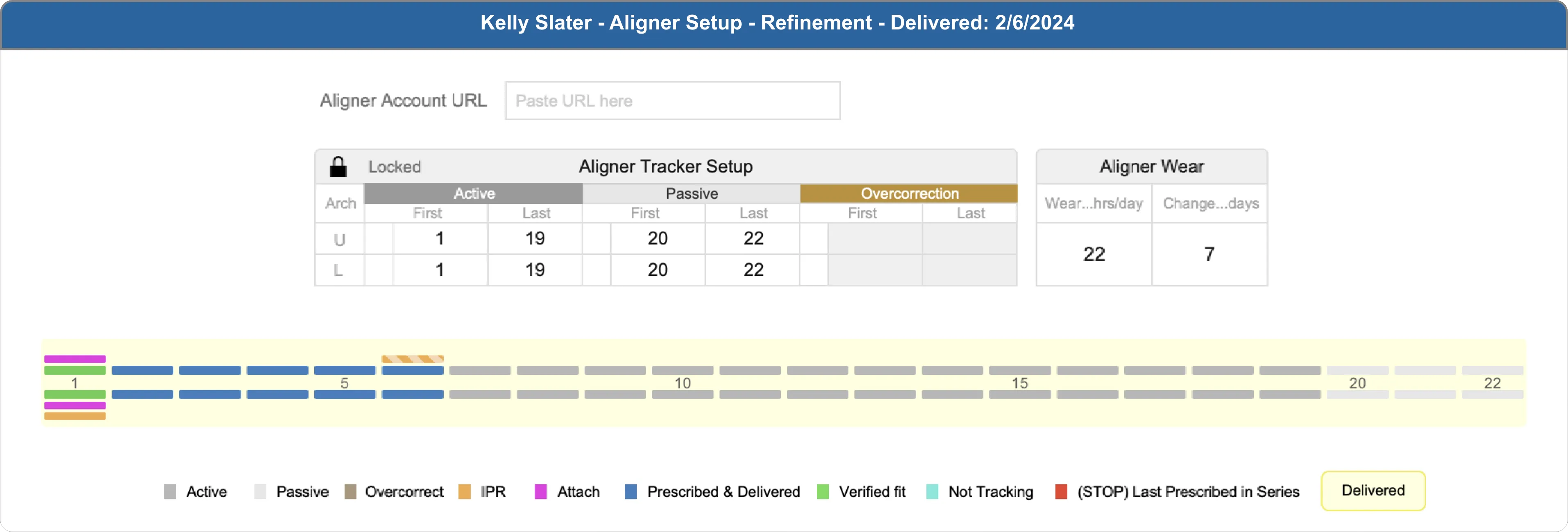 Aligner tracker setup with active, passive, and overcorrection trays plus visual tray-by-tray timeline