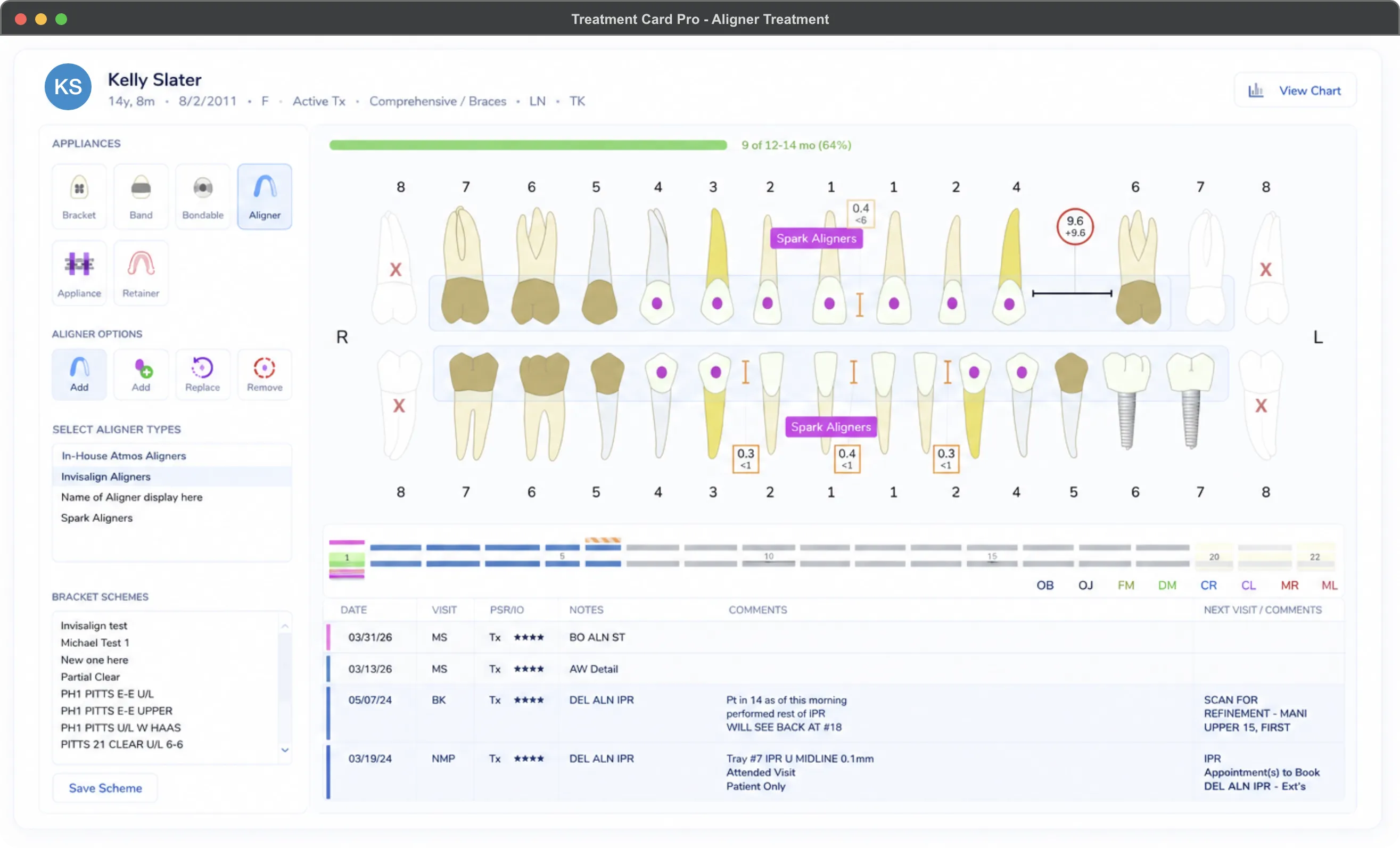 Treatment Card Pro overview showing patient chart with visual tooth chart, aligner tracker, and chart notes