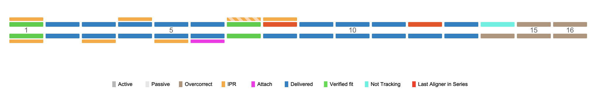 A screenshot of the Aligner Timeline, showing different different colored blocks to indicate the status of aligners, IPR, and Attachments and a legend with labels