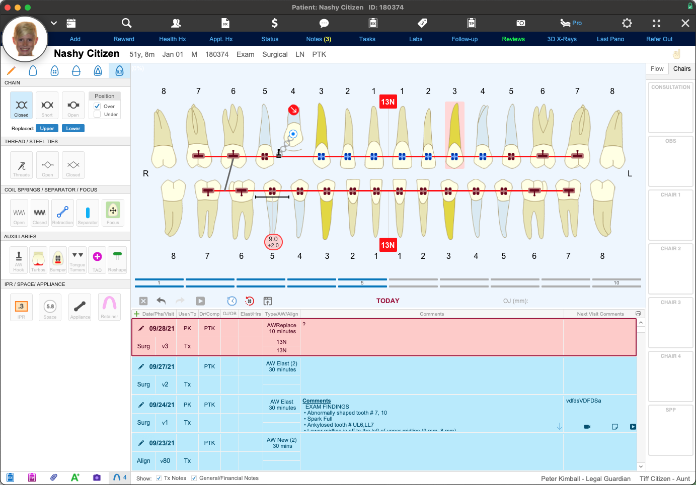 A screenshot of the WaveOrtho Treatment Card Pro, showing the list of components on the left, the tooth chart and aligner timeline in the center, and an appointment history below